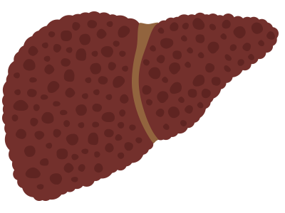 A liver with cirrhosis may not work as it should